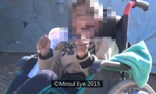 Дауны синдромтой гэх хүүхдүүдийг цаазалжээ
