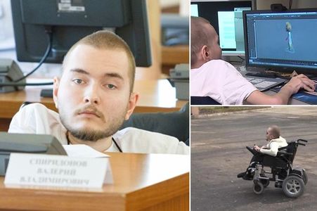 Толгой шилжүүлэх мэс засалд орос эмч оролцоно