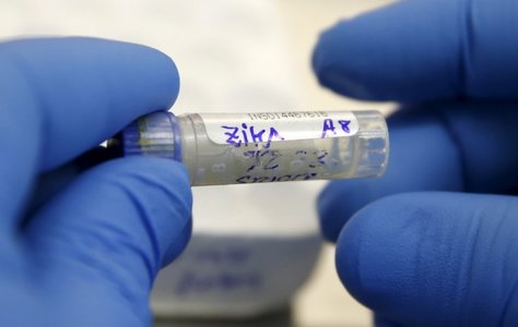 Зика вирус бэлгийн замаар халдварлажээ