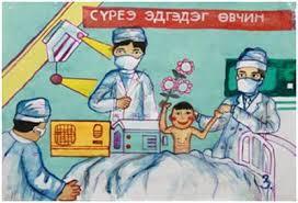 Сүрьеэ өвчний шинж тэмдэг, урьдчилан сэргийлэх аргууд