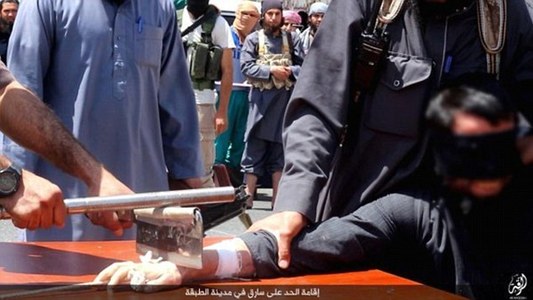 Тамхичдын гарыг цавчжээ