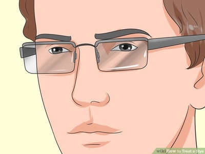 Нүдэн дээр өвдөг гарсан үед хориглох зүйл