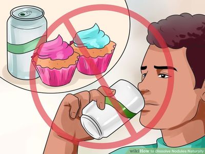 Турахыг хүссэн хүмүүсийн татгалзах зүйлс