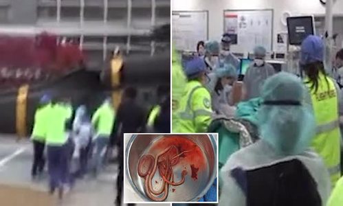 Цэргийн гэдэс дотроос гарсан туузан хорхойны зургийг нийтэлжээ
