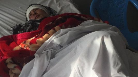 Шалтгаангүйгээр эхнэрийнхээ чихийг огтолжээ