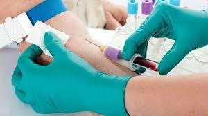 В, С вирусын шинжилгээнд 230 мянган хүн хамрагджээ