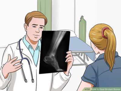 Ясаа хугалж, гэмтээсэн үед хэрхэх вэ