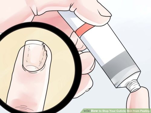 ХУМС хугаралтыг зогсоох ШИДЭТ арга