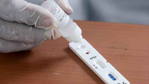 Грек: Иргэдэд COVID-19 илрүүлэх тест үнэ төлбөргүй тараана