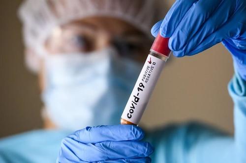 ДЭМБ: Сүүлийн нэг сарын хугацаанд COVID-19 халдвараас үүдэлтэй нас баралт 13 хувиар нэмэгдлээ