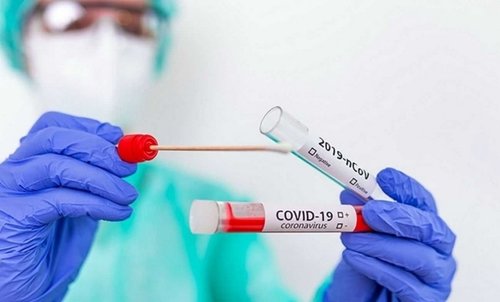 ДЭМБ: Нэгдүгээр сард COVID-19 халдвараас үүдэлтэй нас баралт 65 хувь нэмэгдсэн