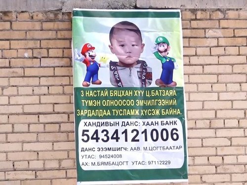 Гурван настай хүү дахин хагалгаанд орно